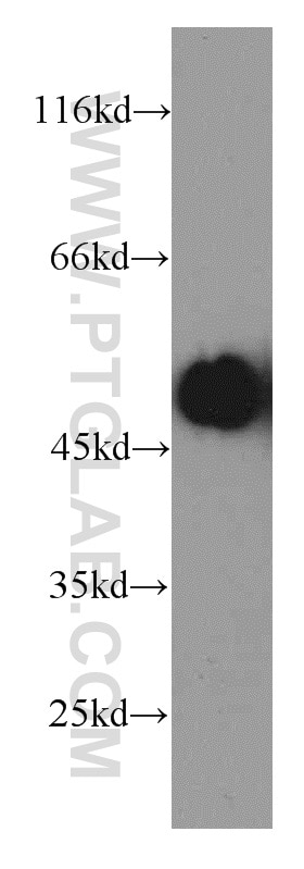 Western Blot (WB) analysis of HepG2 cells using CBLC Polyclonal antibody (13104-1-AP)