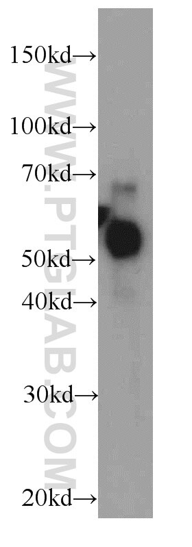 Western Blot (WB) analysis of A549 cells using CBLC Polyclonal antibody (13104-1-AP)