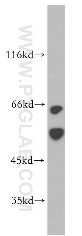 Western Blot (WB) analysis of HepG2 cells using CBLC Polyclonal antibody (13104-1-AP)