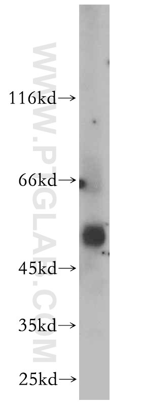 Western Blot (WB) analysis of A549 cells using CBLC Polyclonal antibody (13104-1-AP)