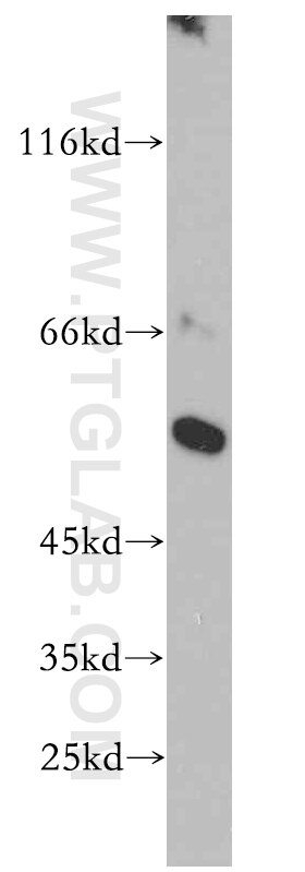 Western Blot (WB) analysis of COLO 320 cells using CBLC Polyclonal antibody (13104-1-AP)