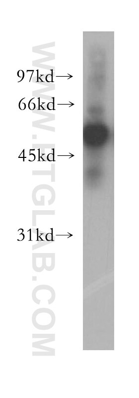 Western Blot (WB) analysis of HeLa cells using CBLC Polyclonal antibody (13104-1-AP)