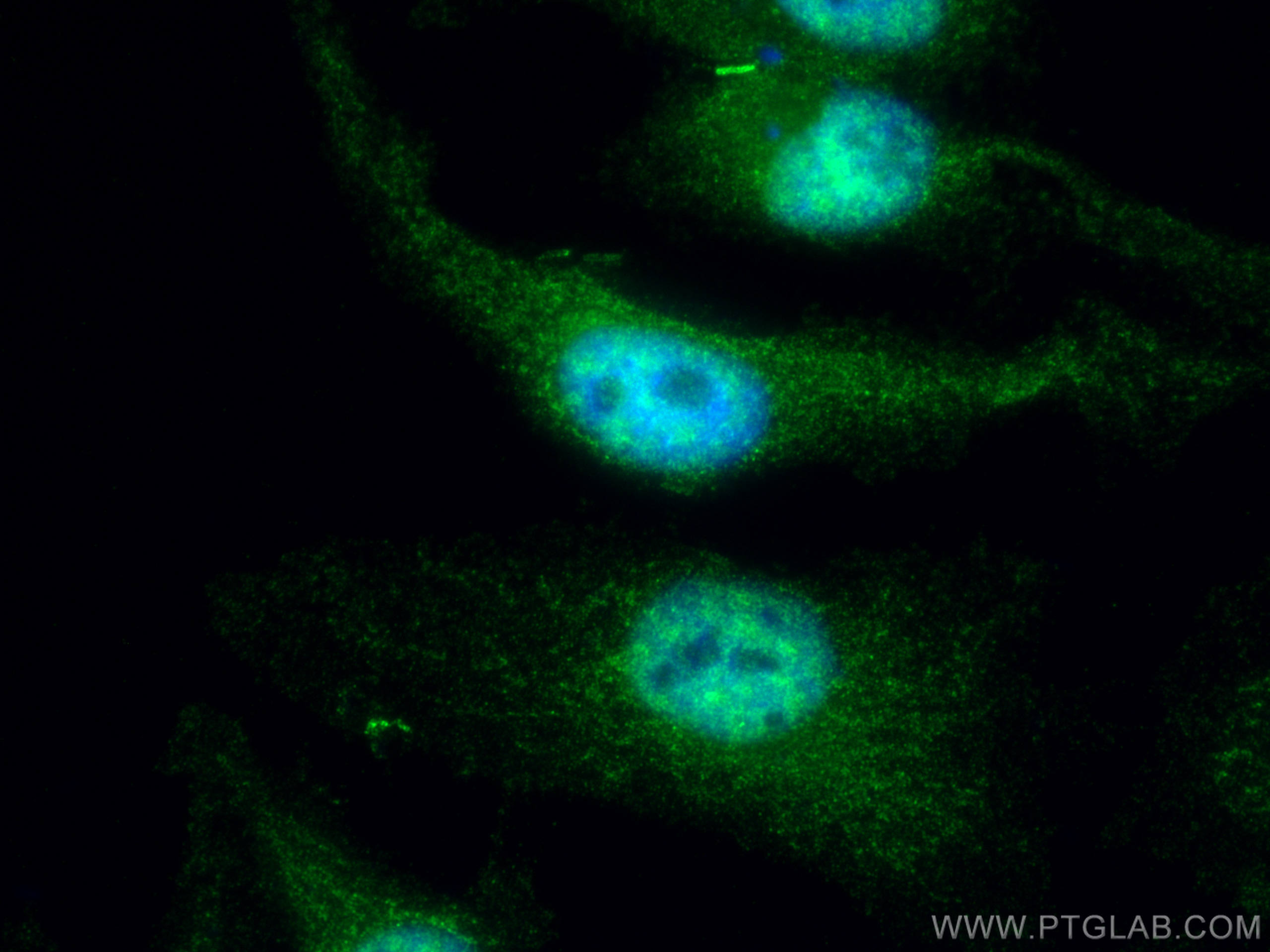 Immunofluorescence (IF) / fluorescent staining of HeLa cells using CBLL1 Polyclonal antibody (21179-1-AP)