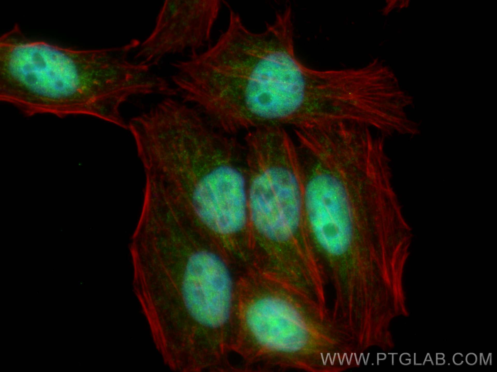 Immunofluorescence (IF) / fluorescent staining of HepG2 cells using CBLL1 Polyclonal antibody (21179-1-AP)
