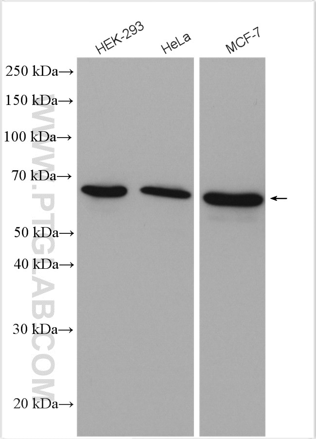 Western Blot (WB) analysis of various lysates using CBLL1 Polyclonal antibody (21179-1-AP)