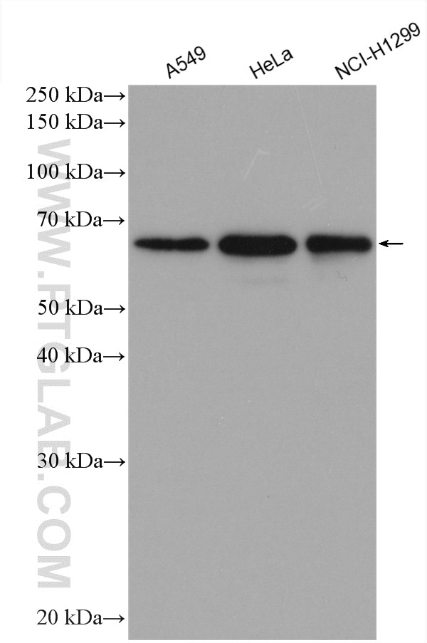 Western Blot (WB) analysis of various lysates using CBLL1 Polyclonal antibody (29219-1-AP)