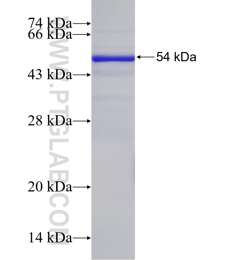 CBLL1 fusion protein Ag33328 SDS-PAGE CBLL1 fusion protein Ag33328 SDS-PAGE