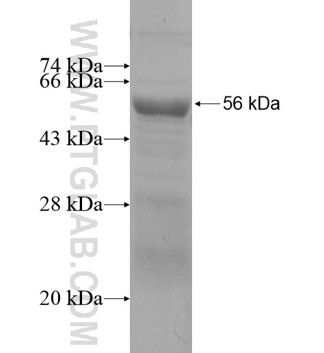 CBLL1 fusion protein Ag15463 SDS-PAGE