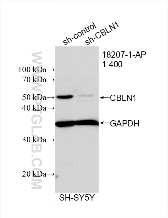 Western Blot (WB) analysis of SH-SY5Y cells using CBLN1 Polyclonal antibody (18207-1-AP)