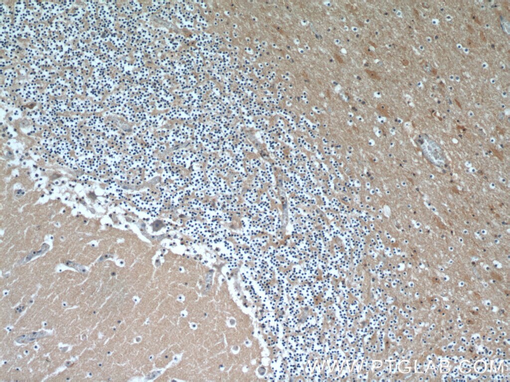 IHC staining of human cerebellum using 20559-1-AP