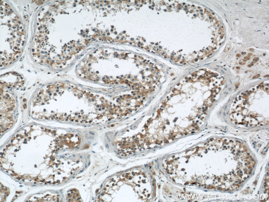 IHC staining of human testis using 20559-1-AP