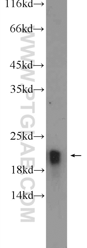 Western Blot (WB) analysis of mouse kidney tissue using CBLN4 Polyclonal antibody (20559-1-AP)