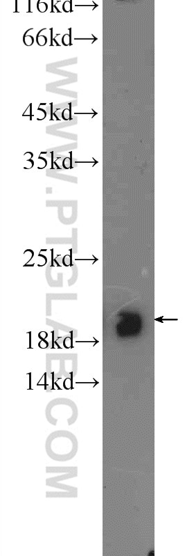 Western Blot (WB) analysis of mouse cerebellum tissue using CBLN4 Polyclonal antibody (20559-1-AP)