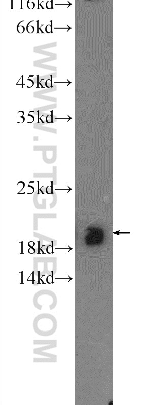 WB analysis of mouse cerebellum using 20559-1-AP