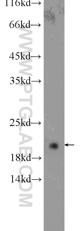 Western Blot (WB) analysis of mouse brain tissue using CBLN4 Polyclonal antibody (20559-1-AP)