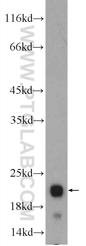 Western Blot (WB) analysis of mouse kidney tissue using CBLN4 Polyclonal antibody (20559-1-AP)