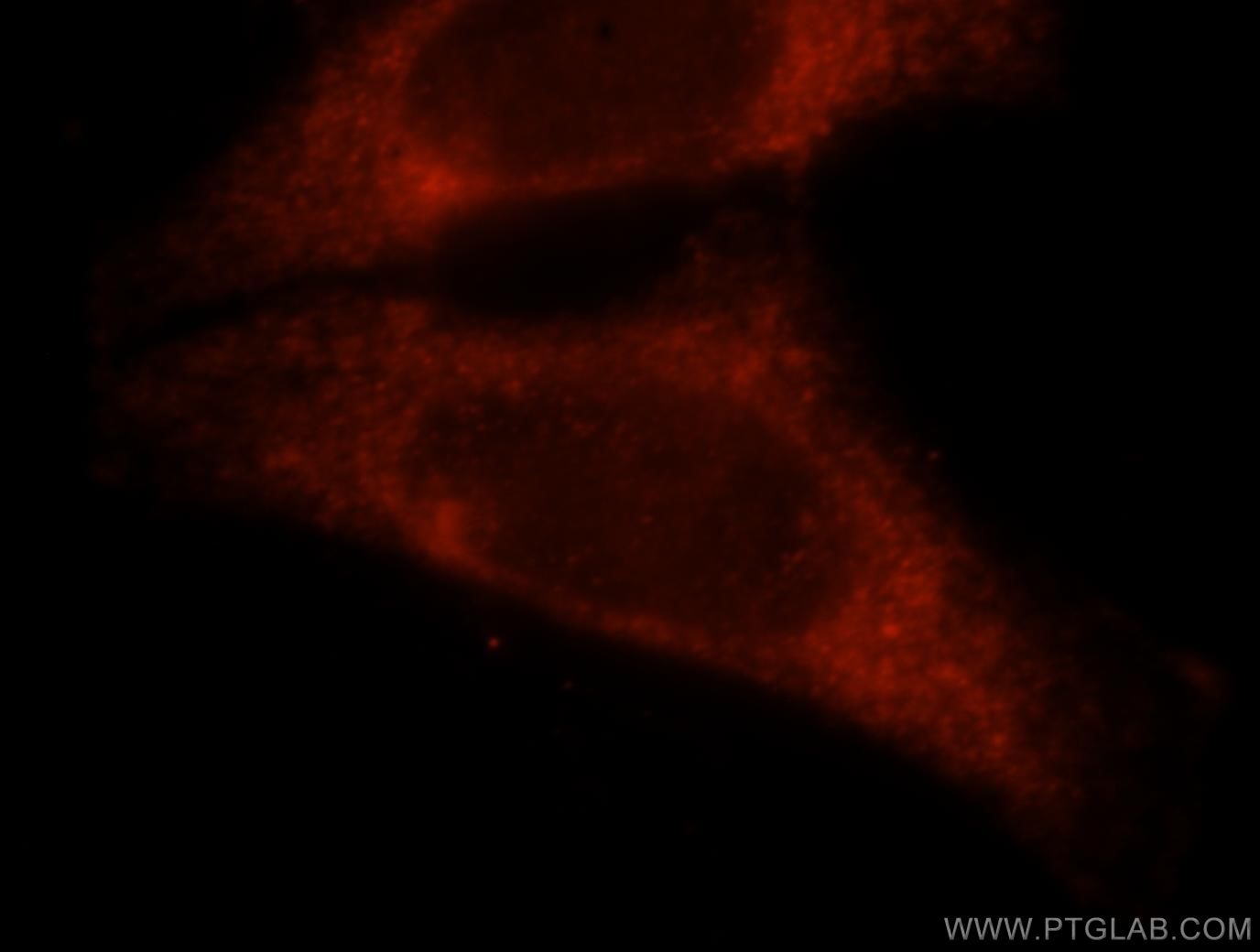 IF Staining of HepG2 using 11149-1-AP