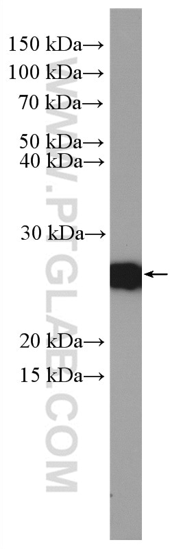Western Blot (WB) analysis of HEK-293T cells using EIF4E Polyclonal antibody (11149-1-AP)