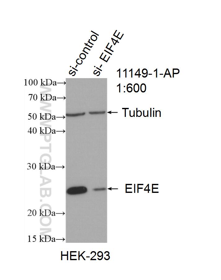 Western Blot (WB) analysis of HEK-293 cells using EIF4E Polyclonal antibody (11149-1-AP)