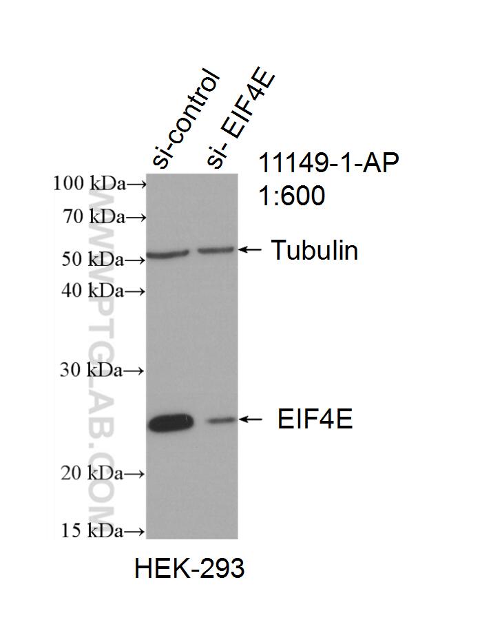 WB analysis of HEK-293 using 11149-1-AP