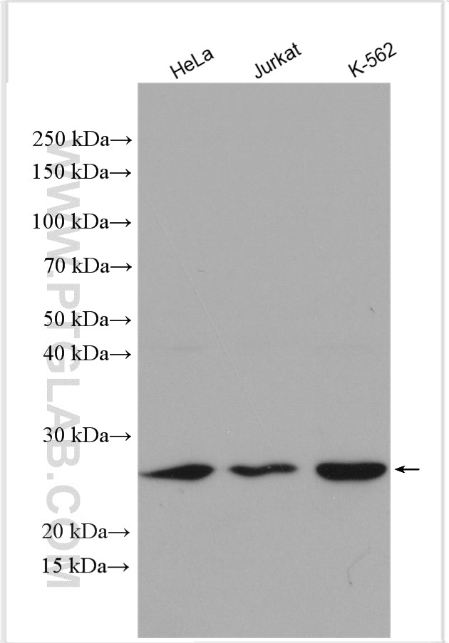Western Blot (WB) analysis of various lysates using EIF4E Polyclonal antibody (11149-1-AP)