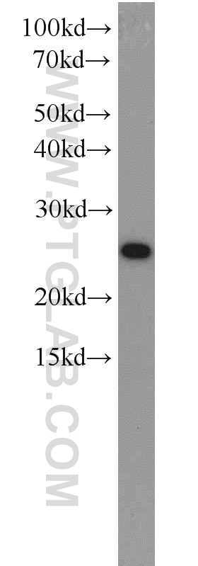 Western Blot (WB) analysis of HEK-293 cells using EIF4E Polyclonal antibody (11149-1-AP)