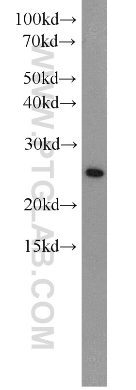 EIF4E Polyclonal antibody