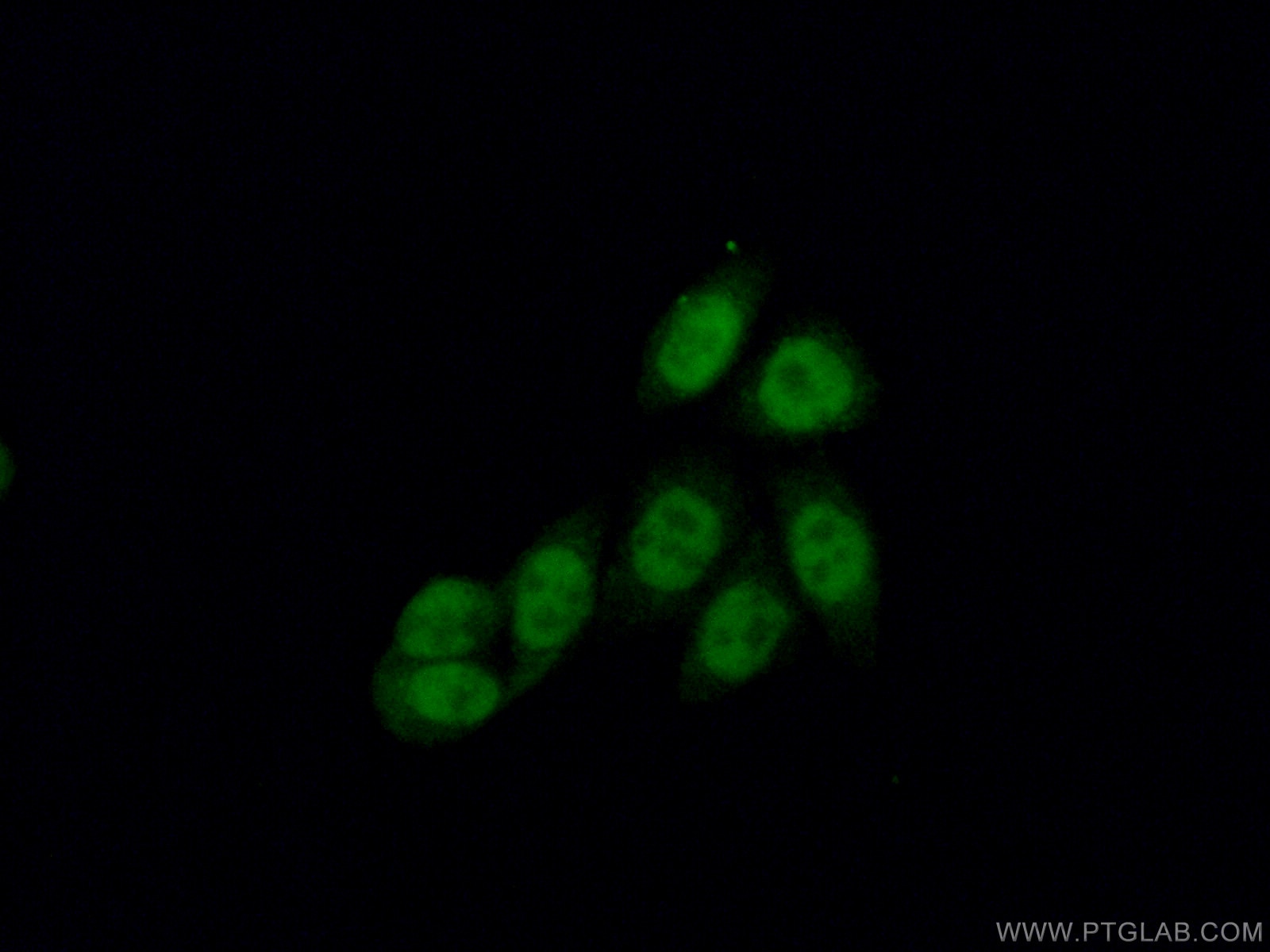 Immunofluorescence (IF) / fluorescent staining of HeLa cells using CBP20 Polyclonal antibody (11950-1-AP)