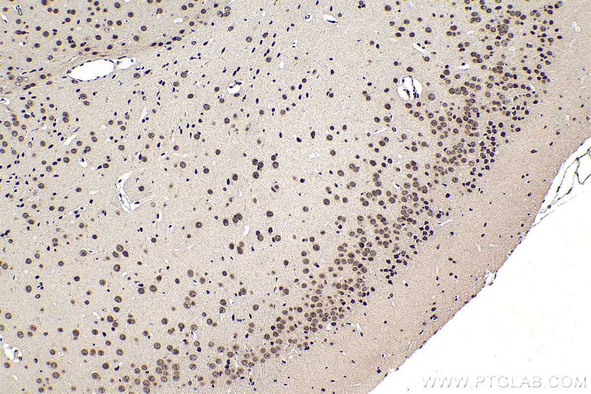 Immunohistochemistry (IHC) staining of mouse brain tissue using CBP20 Polyclonal antibody (11950-1-AP)