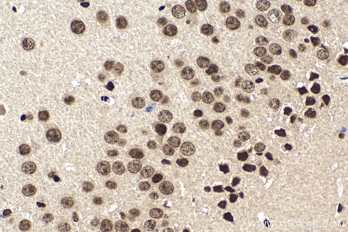Immunohistochemistry (IHC) staining of mouse brain tissue using CBP20 Polyclonal antibody (11950-1-AP)