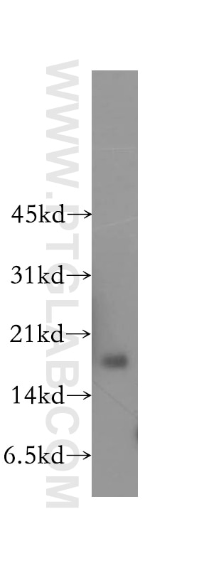 Western Blot (WB) analysis of human heart tissue using CBP20 Polyclonal antibody (11950-1-AP)