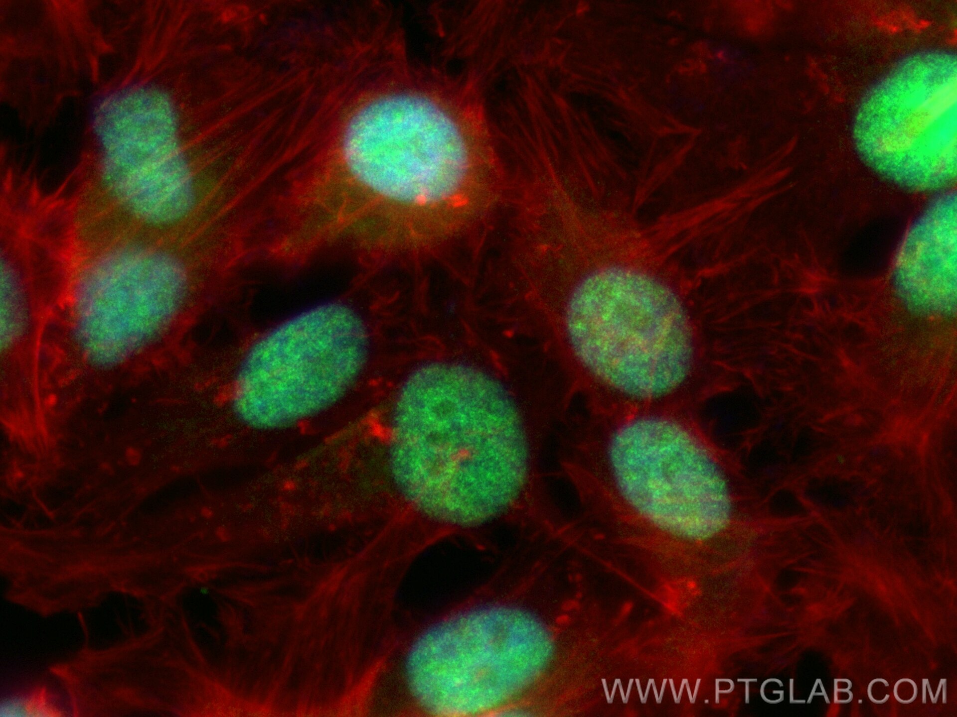 Immunofluorescence (IF) / fluorescent staining of HeLa cells using CoraLite® Plus 488-conjugated CBP20 Polyclonal ant (CL488-11950)