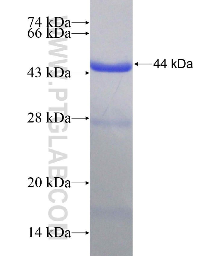 CBP20 fusion protein Ag2550 SDS-PAGE