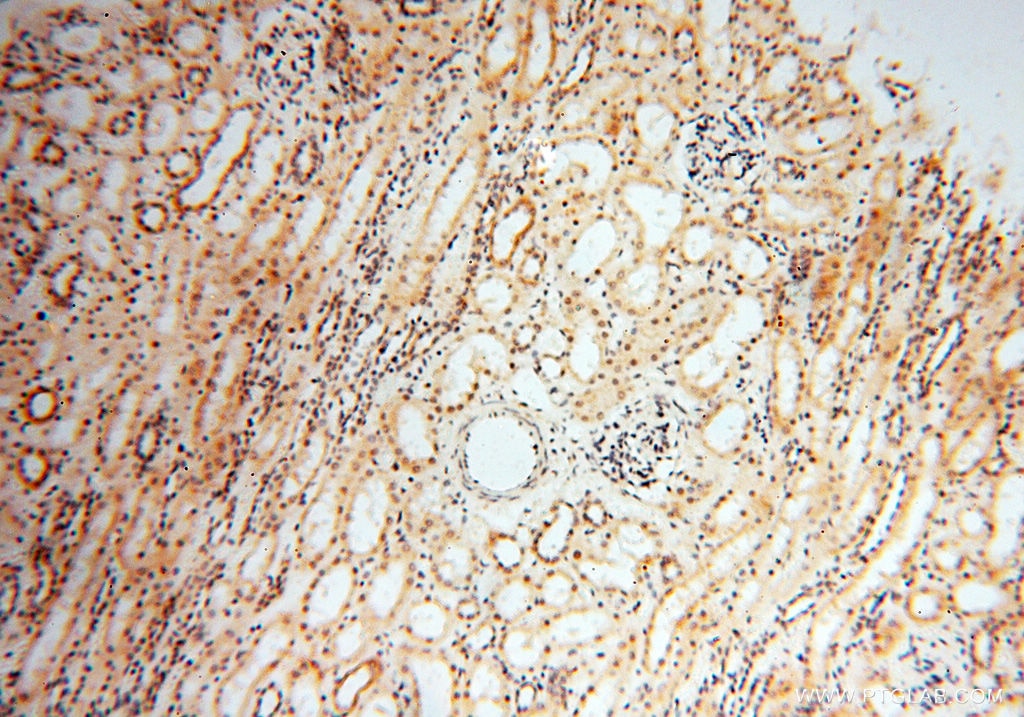 IHC staining of human kidney using 10349-1-AP