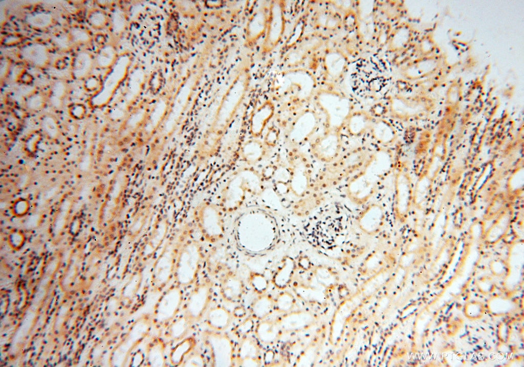 Immunohistochemistry (IHC) staining of human kidney tissue using NCBP1 Polyclonal antibody (10349-1-AP)