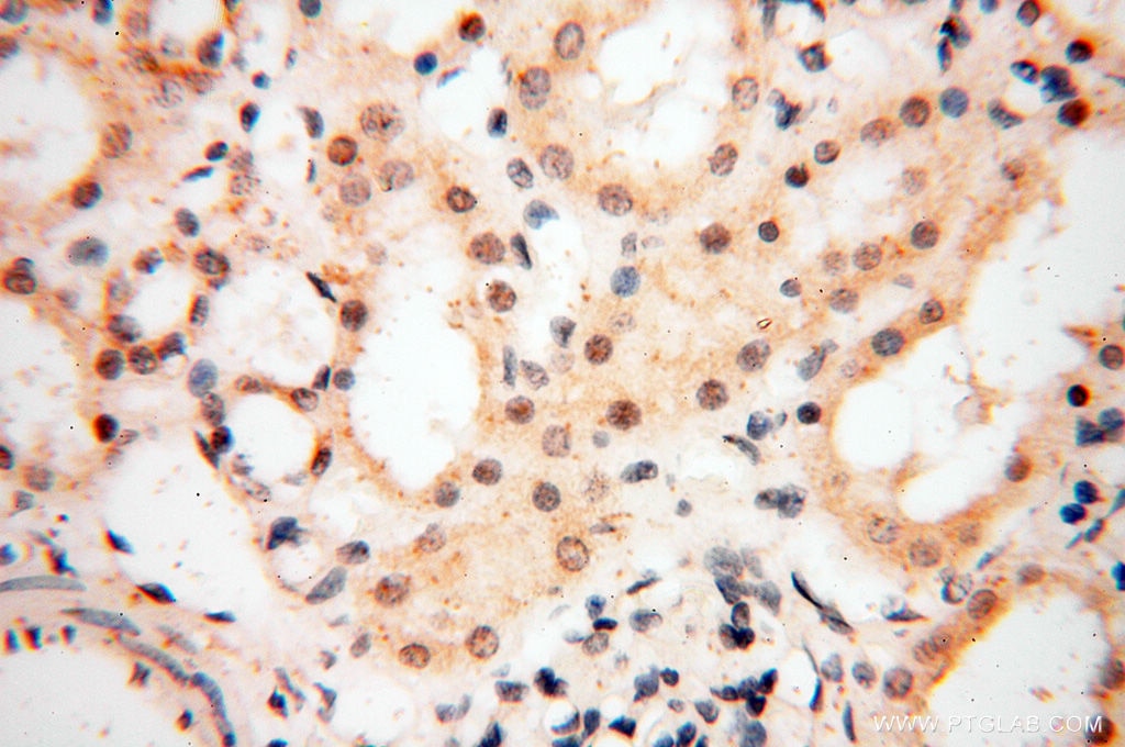Immunohistochemistry (IHC) staining of human kidney tissue using NCBP1 Polyclonal antibody (10349-1-AP)