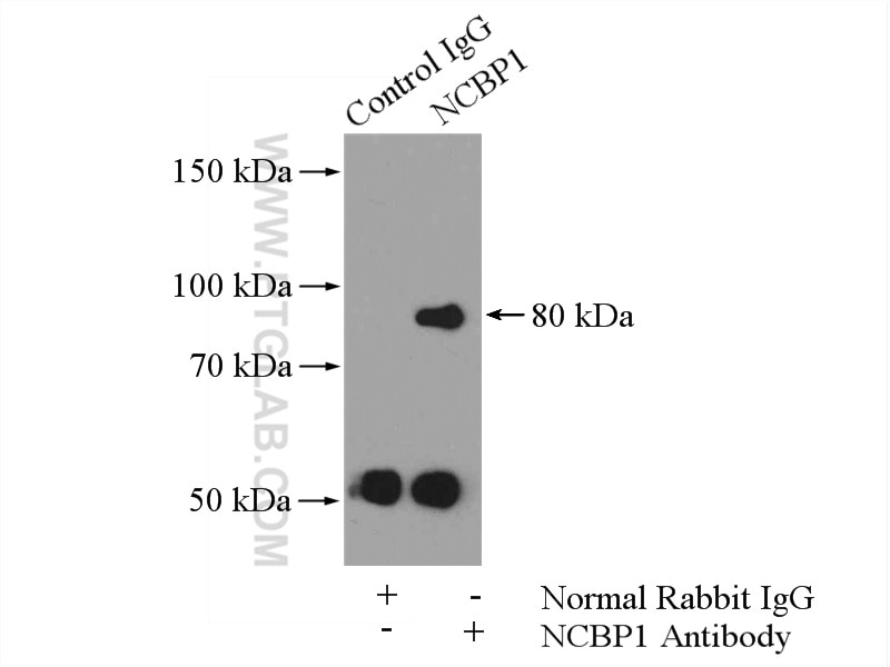 Immunoprecipitation (IP) experiment of HeLa cells using NCBP1 Polyclonal antibody (10349-1-AP)