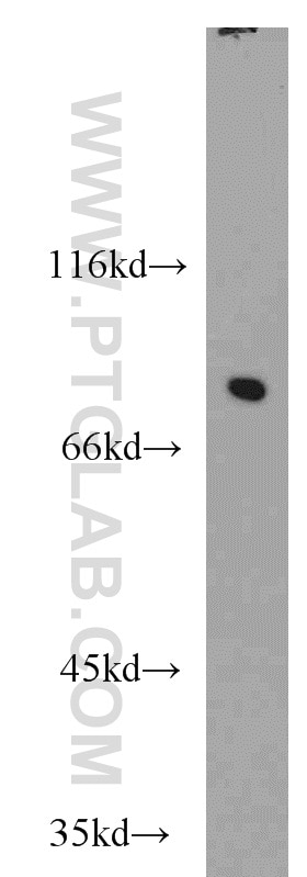 Western Blot (WB) analysis of HeLa cells using NCBP1 Polyclonal antibody (10349-1-AP)