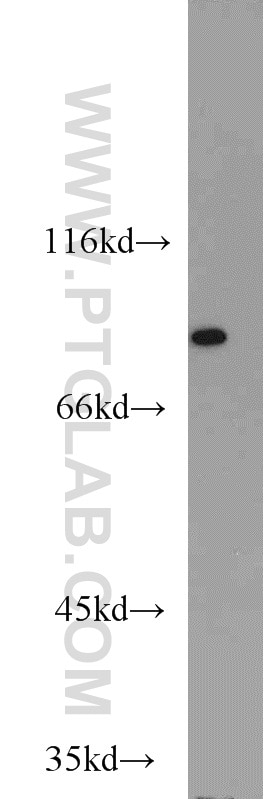 Western Blot (WB) analysis of HEK-293 cells using NCBP1 Polyclonal antibody (10349-1-AP)