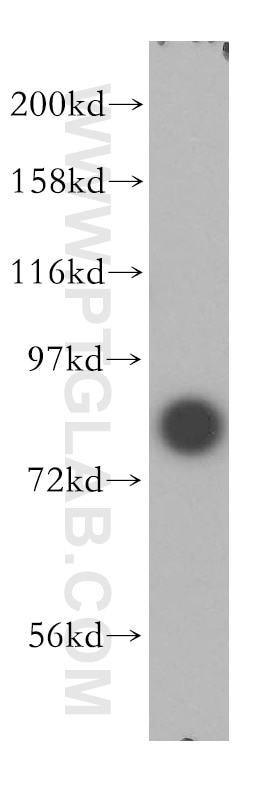 Western Blot (WB) analysis of human brain tissue using NCBP1 Polyclonal antibody (10349-1-AP)