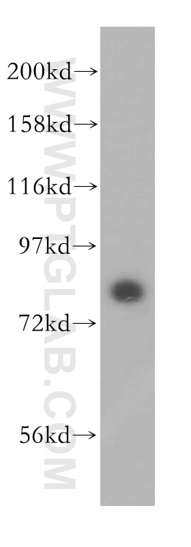 Western Blot (WB) analysis of HeLa cells using NCBP1 Polyclonal antibody (10349-1-AP)