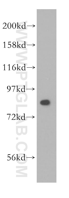 Western Blot (WB) analysis of HEK-293 cells using NCBP1 Polyclonal antibody (10349-1-AP)