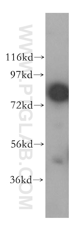 Western Blot (WB) analysis of HeLa cells using NCBP1 Polyclonal antibody (10349-1-AP)