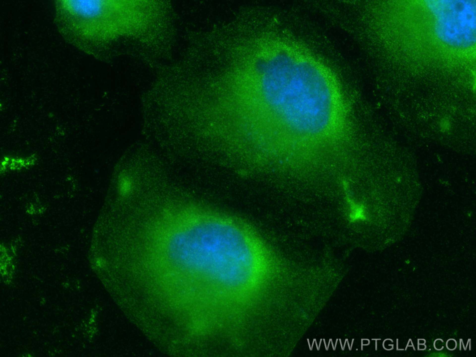 Immunofluorescence (IF) / fluorescent staining of HeLa cells using CBR1 Polyclonal antibody (31279-1-AP)