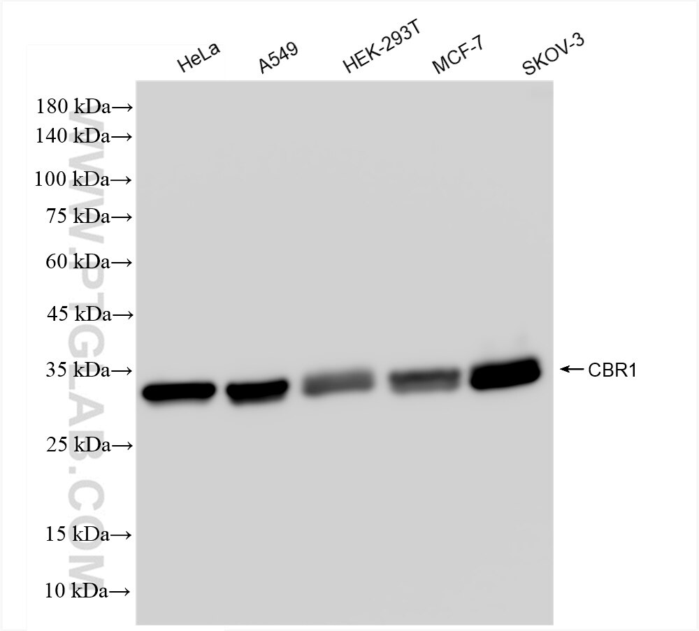 Western Blot (WB) analysis of various lysates using CBR1 Recombinant antibody (83736-4-RR)