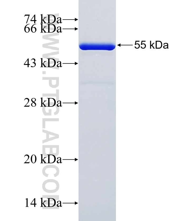 CBR1 fusion protein Ag34830 SDS-PAGE