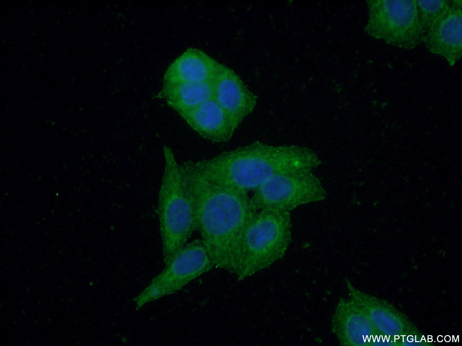 Immunofluorescence (IF) / fluorescent staining of HeLa cells using CBR3 Polyclonal antibody (15619-1-AP)