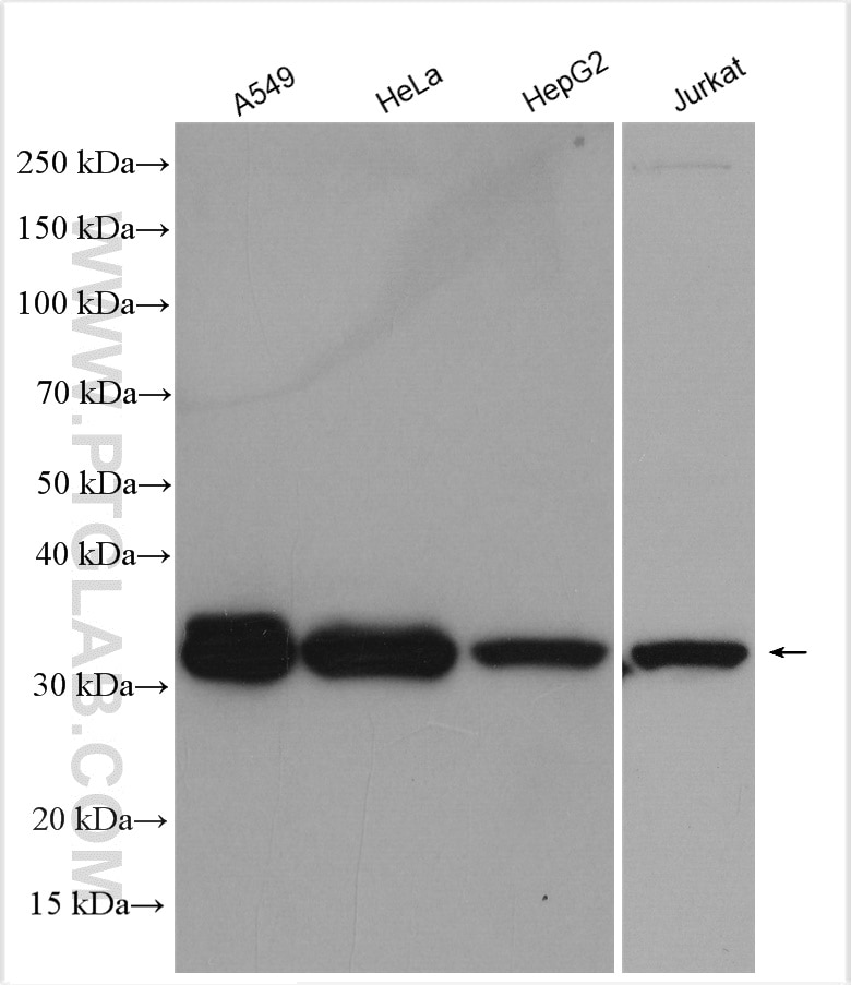 Western Blot (WB) analysis of various lysates using CBR3 Polyclonal antibody (15619-1-AP)