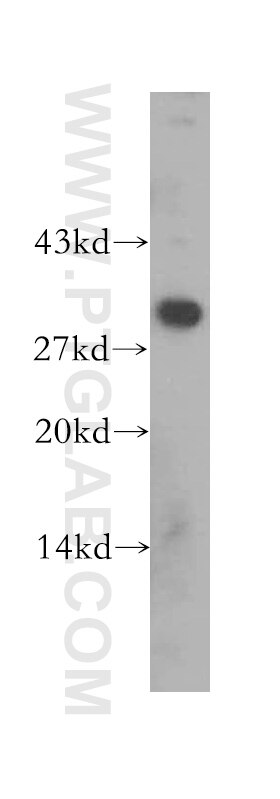 Western Blot (WB) analysis of Jurkat cells using CBR3 Polyclonal antibody (15619-1-AP)