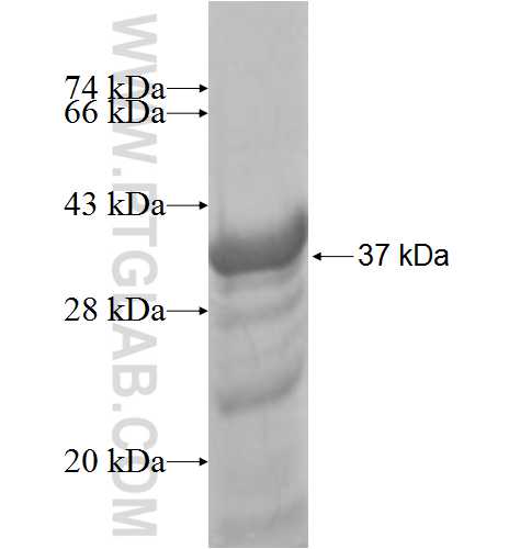 CBR3 fusion protein Ag7740 SDS-PAGE